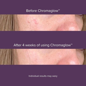 Chromaglow™-7-Color-Skincare-Wand