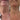 Before and after close-up showing smoother neck skin with reduced crepiness after Equinox Pro treatment